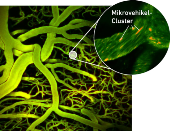 EUU Researchers Achieve Breakthrough: Guiding Microvehicles Through Brain Blood Vessels Using Ultraso